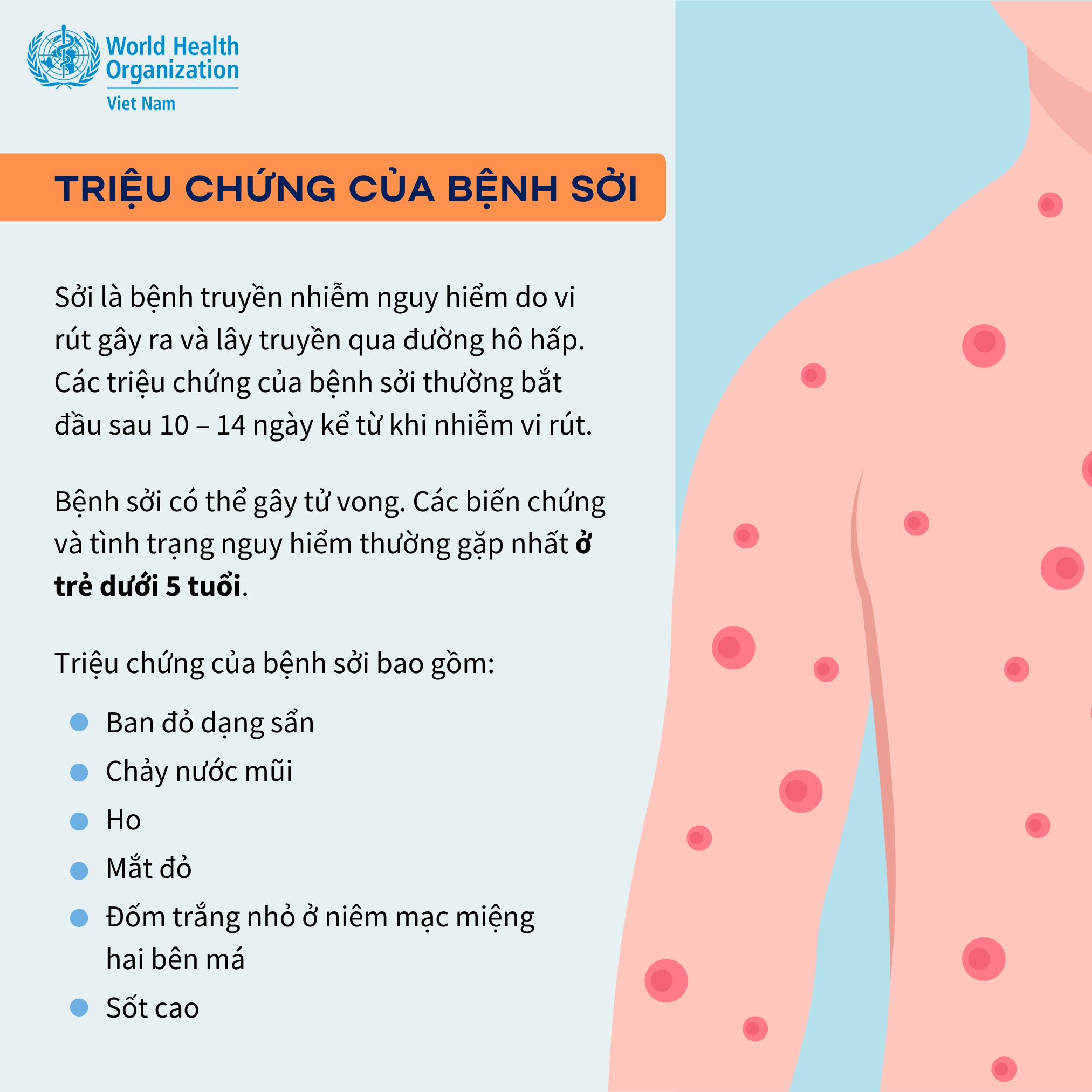 Khuyến cáo phòng chống bệnh Sởi